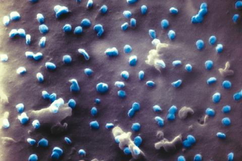 Faszinierend: Coronaviren (blau) beim Austritt aus einer Nierenzelle, aufgenommen mit einem Heliumionen-Mikroskop. Foro: Universität Bielefeld/ Frese 