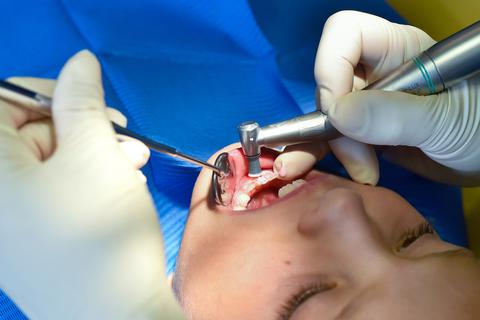 Zahnärzte gelten wegen der nahen Arbeit am Mund als besonders gefährdete Berufsgruppe. Symbolfoto: dpa