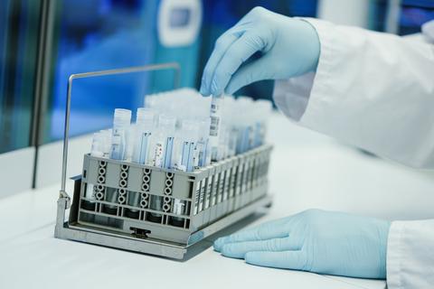 Ein Mitarbeiter hält in einem Corona-Testlabor PCR-Teströhrchen in den Händen.  Foto: dpa